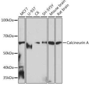 Calcineurin A Rabbit mAb