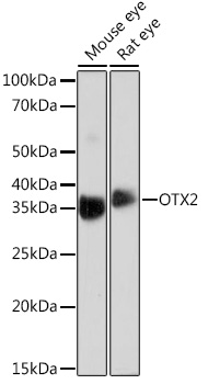 OTX2 Rabbit mAb