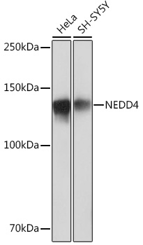 NEDD4 Rabbit mAb