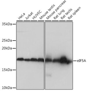 eIF5A Rabbit mAb