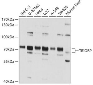 TRIOBP Rabbit pAb