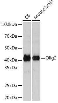 Olig2 Rabbit mAb