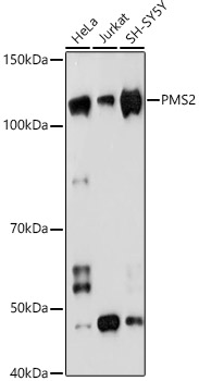 PMS2 Rabbit mAb