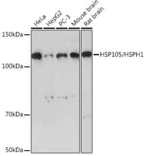 HSP105/HSPH1 Rabbit mAb