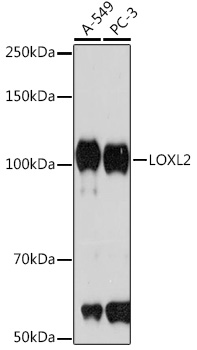 LOXL2 Rabbit mAb