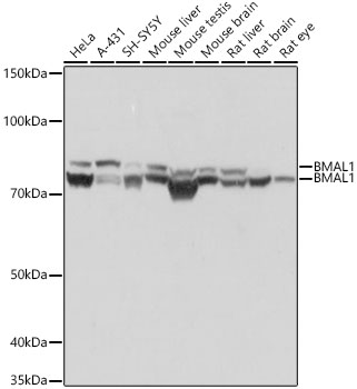 BMAL1 Rabbit mAb