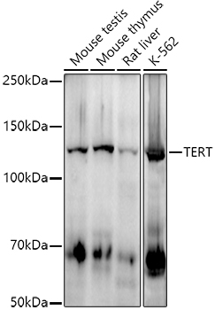 TERT Rabbit mAb