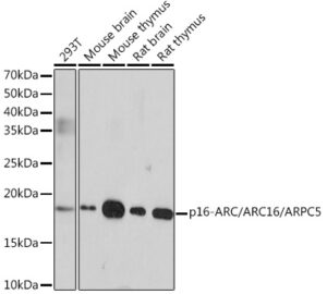 p16-ARC/ARC16/ARPC5 Rabbit mAb