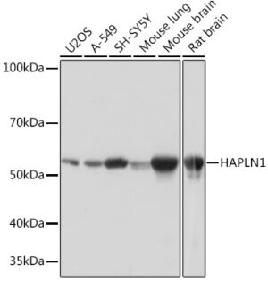 HAPLN1 Rabbit mAb
