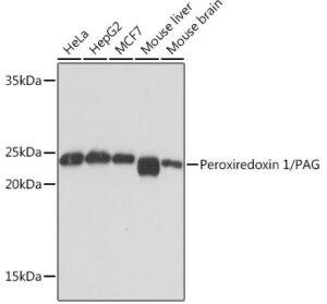 Peroxiredoxin 1/PAG Rabbit mAb
