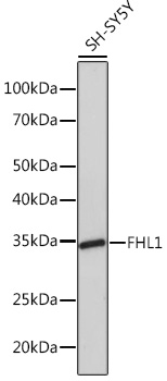 FHL1 Rabbit mAb
