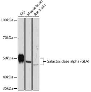 Galactosidase alpha (GLA) Rabbit mAb