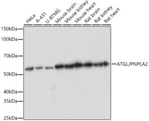 ATGL/PNPLA2 Rabbit mAb