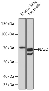 PIAS2 Rabbit mAb