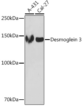 Desmoglein 3 Rabbit mAb