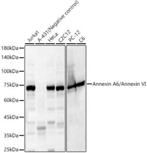Annexin A6/Annexin VI Rabbit pAb