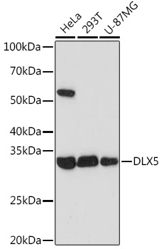 DLX5 Rabbit mAb