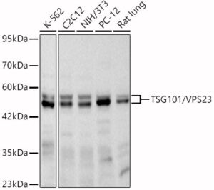 TSG101/VPS23 Rabbit mAb