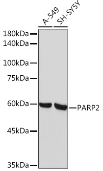 PARP2 Rabbit mAb