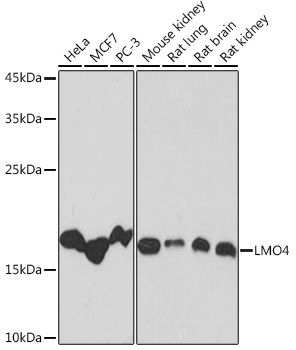 LMO4 Rabbit mAb