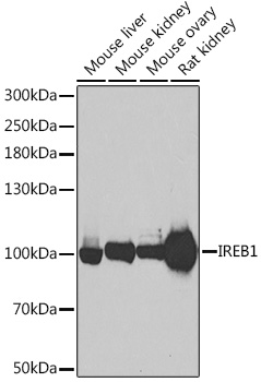 Aconitase 1 (ACO1) Rabbit pAb
