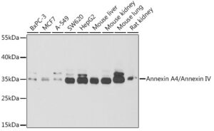 Annexin A4/Annexin IV Rabbit pAb