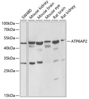 ATP6AP2 Rabbit pAb