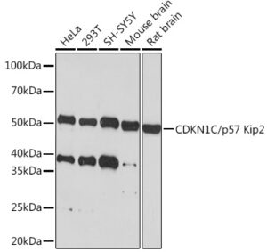 CDKN1C/p57 Kip2 Rabbit mAb
