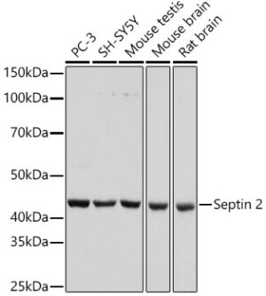 Septin 2 Rabbit mAb