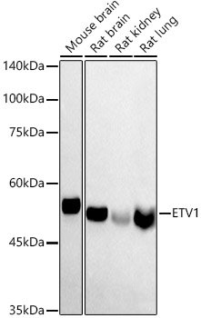 ETV1 Rabbit pAb