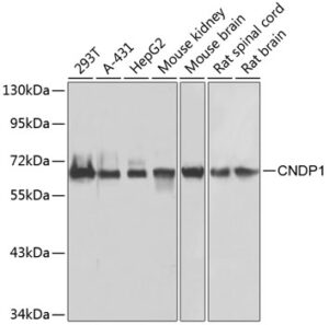CNDP1 Rabbit pAb