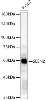 SESN2 Rabbit pAb