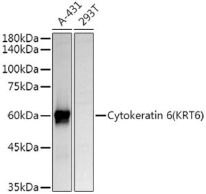 Cytokeratin 6 (KRT6) Rabbit pAb