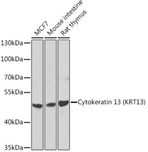 Cytokeratin 13 (KRT13) Rabbit pAb