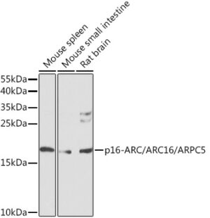 p16-ARC/ARC16/ARPC5 Rabbit pAb