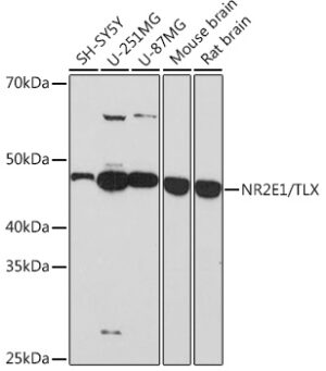 NR2E1/TLX Rabbit mAb