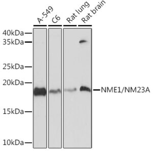 NME1/NM23A Rabbit mAb