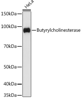 Butyrylcholinesterase Rabbit mAb
