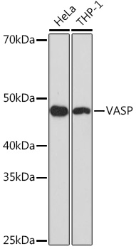 VASP Rabbit mAb