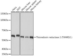 Thioredoxin reductase 2 (TXNRD2 ) Rabbit mAb