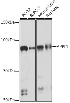 APPL1 Rabbit mAb