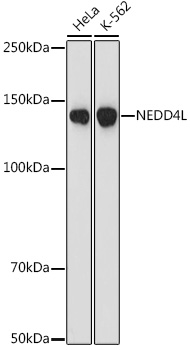 NEDD4L Rabbit mAb