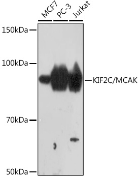 KIF2C/MCAK Rabbit mAb