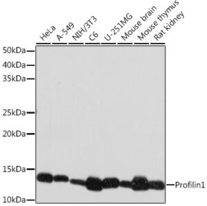 Profilin1 Rabbit mAb