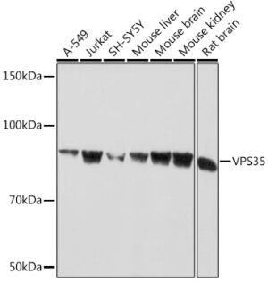 VPS35 Rabbit mAb