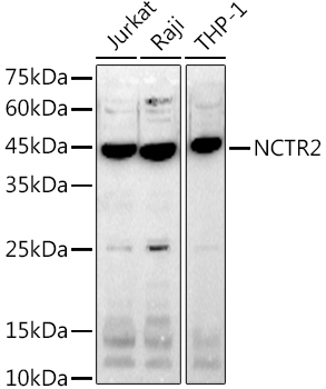 NCTR2 Rabbit mAb