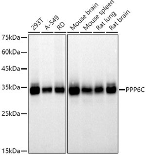 PPP6C Rabbit mAb