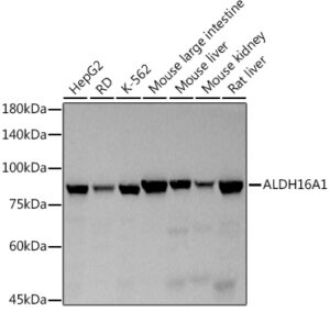 ALDH16A1 Rabbit mAb