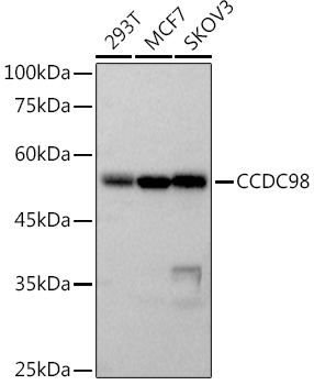 CCDC98 Rabbit mAb