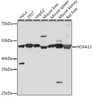HOXA13 Rabbit mAb